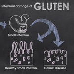 3 BIG Problems With Gluten-Free Eating